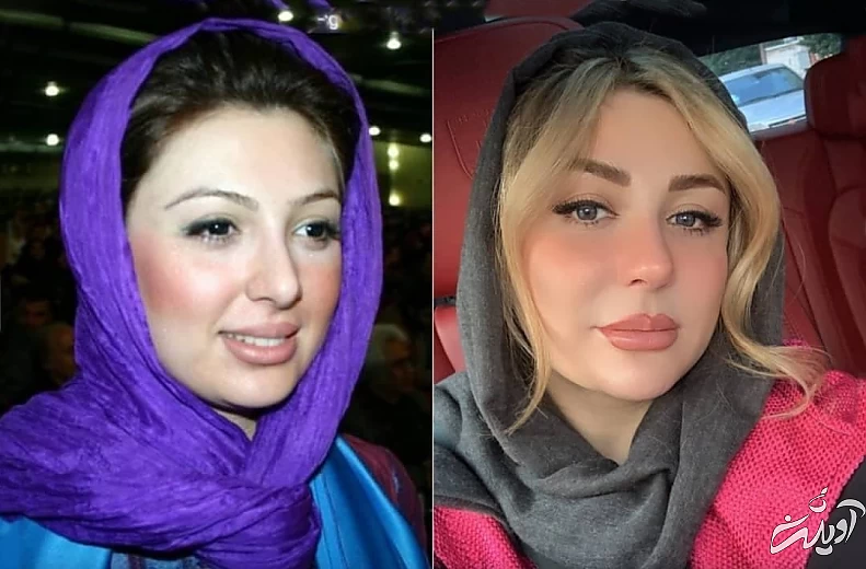 نیوشا ضیغمی